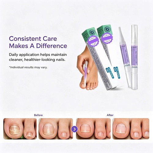 Orivelle swissclear nail - &,