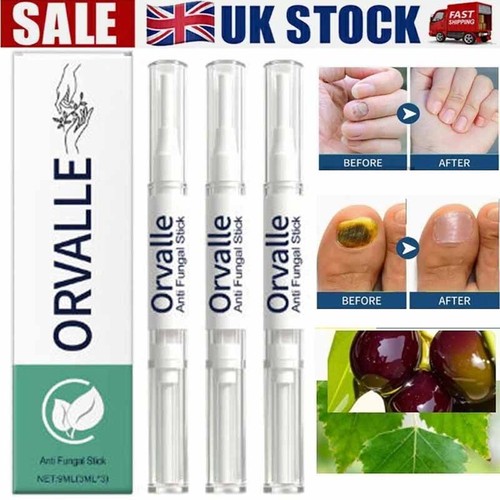 3pcs orville nail fungus - orville,