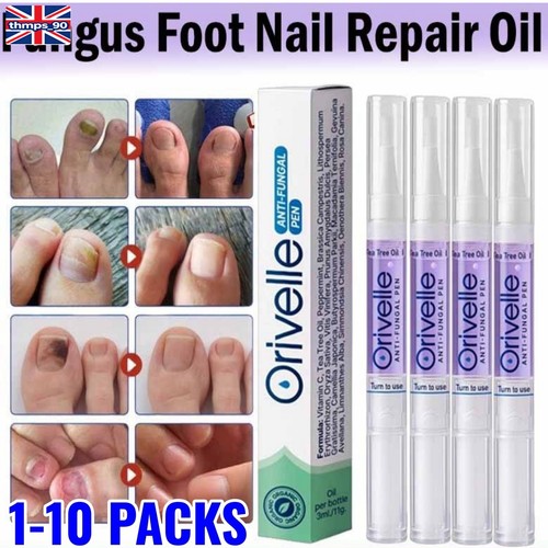 10pcs orivelle antifungal - 1-10pcs,