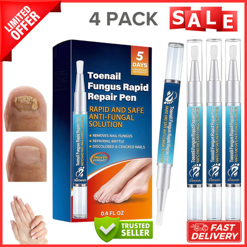 Nail care pen 4pcs fungal - nail,