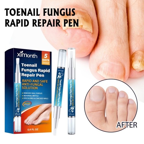 Nail care pen 4pcs fungal - nail,